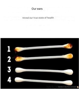 Our ears can reveal more than you think