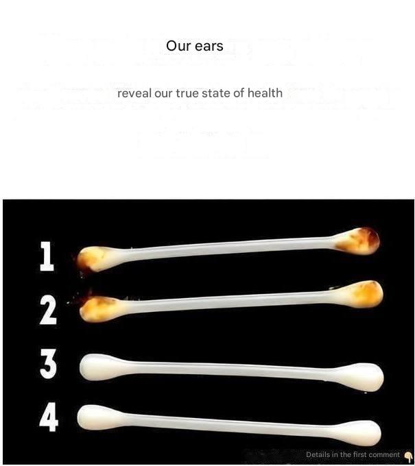 Our ears can reveal more than you think